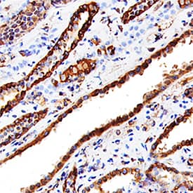 Cathepsin L antibody in Human Kidney by Immunohistochemistry (IHC-P).