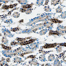 Cathepsin L antibody in Mouse Kidney by Immunohistochemistry (IHC-Fr).