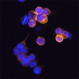 Phospho-Caveolin-1 (Y14) antibody in MCF-7 Human Cell Line by Immunocytochemistry (ICC).