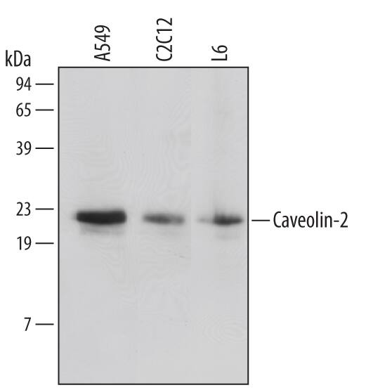 Detection of Human/Mouse/Rat Caveolin-2 antibody by Western Blot.