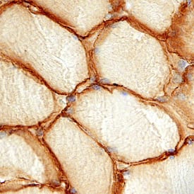 Caveolin-3 antibody in Human Skeletal Muscle by Immunohistochemistry (IHC-P).