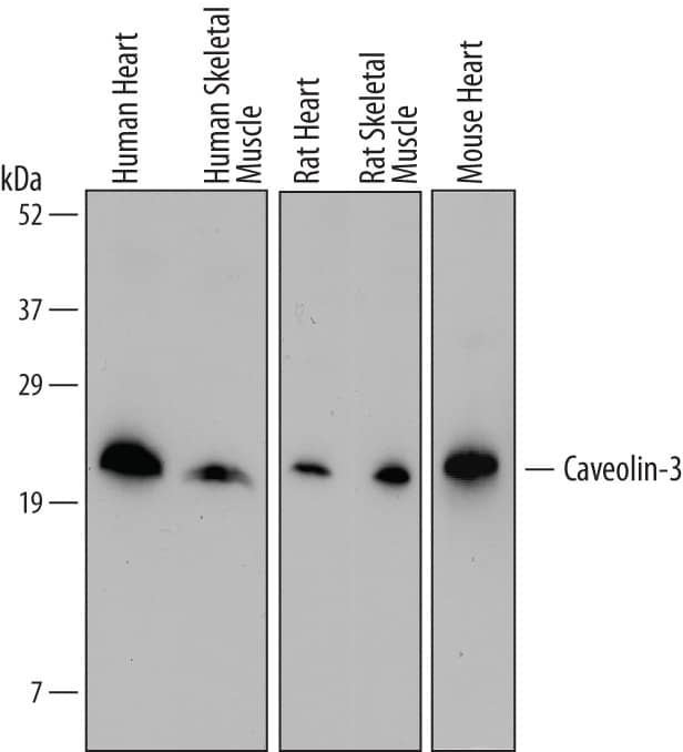 Detection of Human, Mouse, and Rat Caveolin-3 antibody by Western Blot.