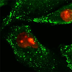 Caveolin-1 antibody in HeLa Human Cell Line by Immunocytochemistry (ICC).