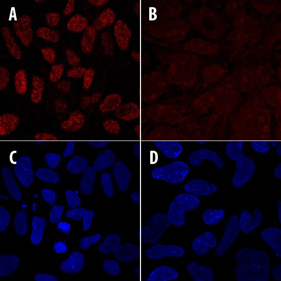 Cbx2 antibody in iPS2 Human Stem Cells by Immunocytochemistry (ICC).