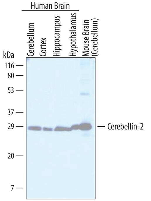 Detection of Human and Mouse Cerebellin-2 antibody by Western Blot.