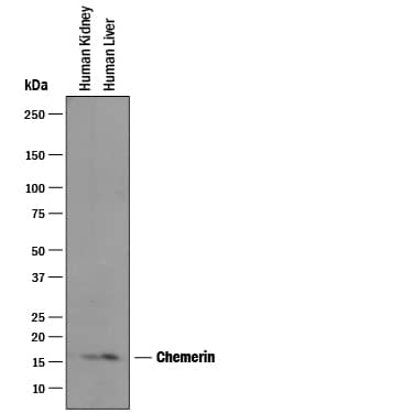 Detection of Human Chemerin antibody by Western Blot.