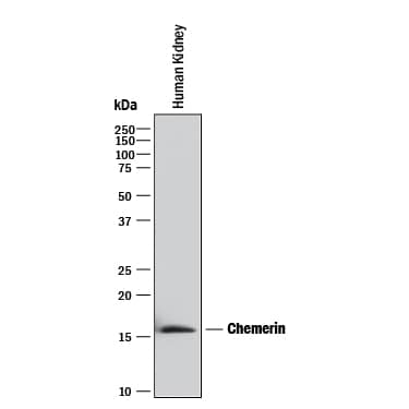 Detection of Human Chemerin antibody by Western Blot.