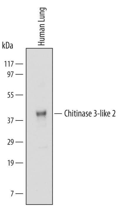 Detection of Human Chitinase 3-like 2 antibody by Western Blot.