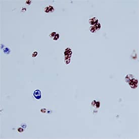 Chitinase 3-like 1 antibody in Human Cartilage by Immunohistochemistry (IHC-P).
