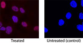 Phospho-Chk2 (T68) antibody in HepG2 Human Cell Line by Immunocytochemistry (ICC).