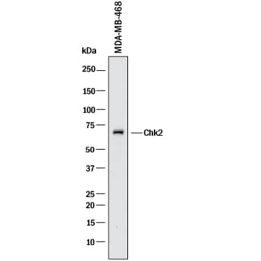 Detection of Human Chk2 antibody by Western Blot.