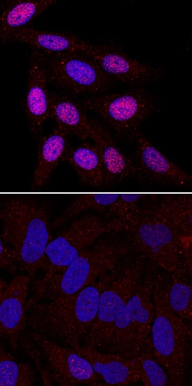 Phospho-Chk2 (T68) antibody in HeLa Human Cell Line by Immunocytochemistry (ICC).