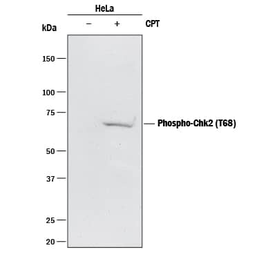 Detection of Human Chk2 antibody by Western Blot.