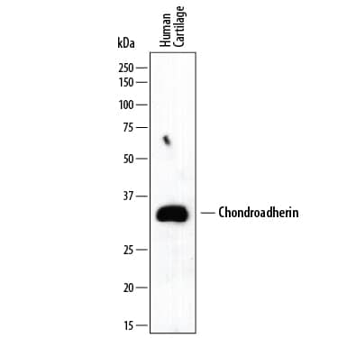 Detection of Human Chondroadherin antibody by Western Blot.