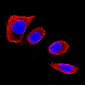 Chondrolectin antibody in PC-3 Human Cell Line by Immunocytochemistry (ICC).