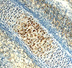 Chordin-like 2/CHRDL2 antibody in Embryonic Mouse Cartilage by Immunohistochemistry (IHC-Fr).