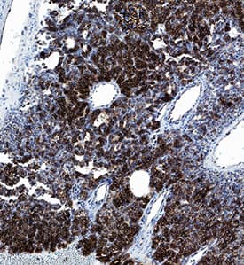 Chromogranin A antibody in Human Parathyroid by Immunohistochemistry (IHC-P).