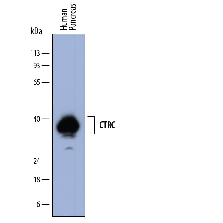 Detection of Human Chymotrypsin C/CTRC antibody by Western Blot.