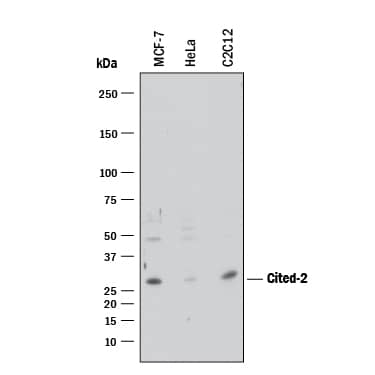 Detection of Human and Mouse Cited-2 antibody by Western Blot.