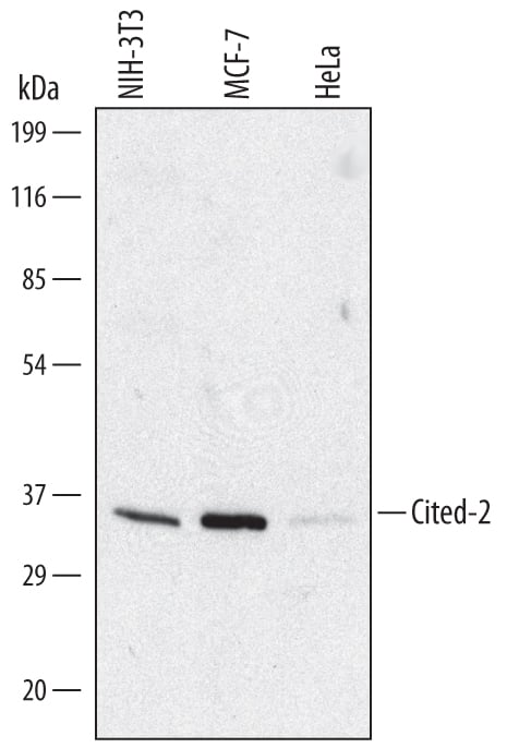 Detection of Human and Mouse Cited-2 antibody by Western Blot.