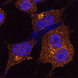 Clathrin Heavy Chain 1/CHC17 antibody in HeLa Human Cell Line by Immunocytochemistry (ICC).