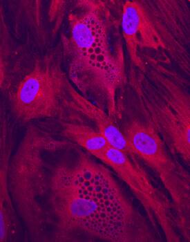 Clathrin Heavy Chain 2/CHC22 antibody in Human Mesenchymal Stem Cells by Immunocytochemistry (ICC).