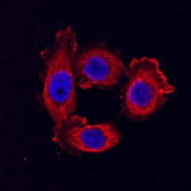 Claudin-3 antibody in PC-3 Human Cell Line by Immunocytochemistry (ICC).