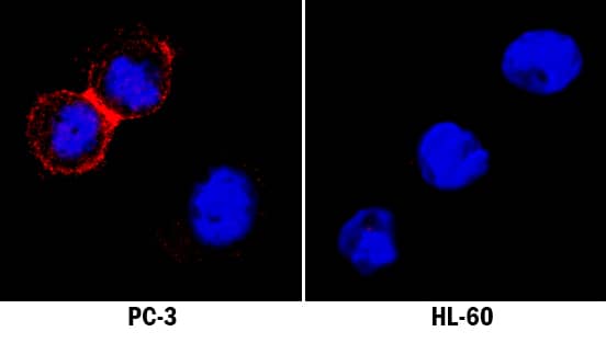 Claudin-4 antibody in PC-3 Human Cell Line by Immunocytochemistry (ICC).