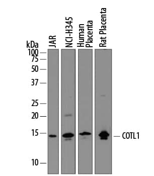 Detection of Human and Rat Coactosin-like Protein 1/COTL1 antibody by Western Blot.