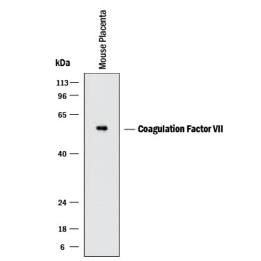 Detection of Mouse Coagulation Factor VII by Western Blot. Detection of Mouse Coagulation Factor VII antibody by Western Blot.