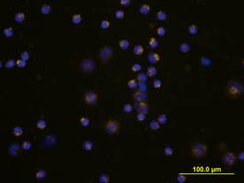 Coagulation Factor VII antibody in Human PBMCs by Immunocytochemistry (ICC).