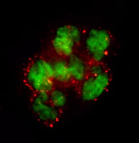 Coagulation Factor VII antibody in Human PBMCs by Immunocytochemistry (ICC).