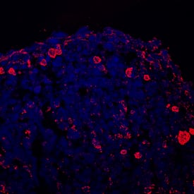 Collagen II antibody in Mouse Chondrocytes by Immunocytochemistry (ICC).