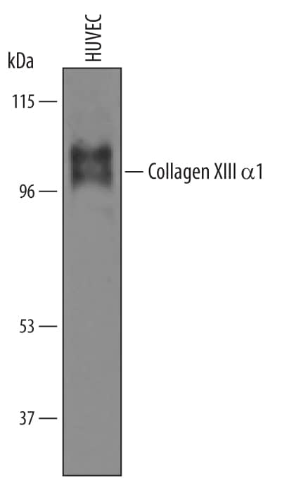 Detection of Human Collagen XIII alpha1 by Western Blot. Detection of Human Collagen XIII a1 antibody by Western Blot.