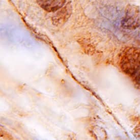 Collagen XIII a1 antibody in Human Placenta by Immunohistochemistry (IHC-P).