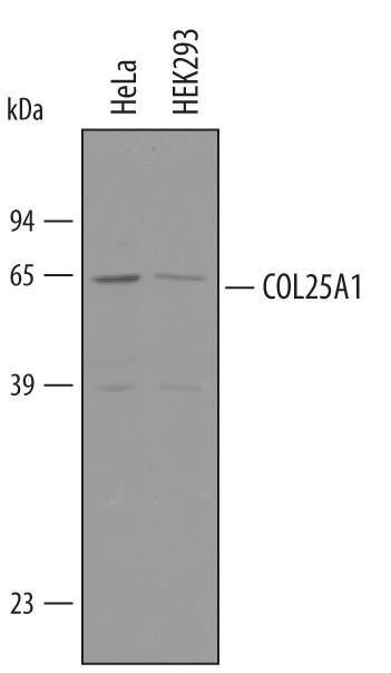 Detection of Human Collagen XXV a1 antibody by Western Blot.