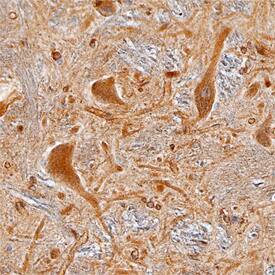 Collybistin/ARHGEF9 antibody in Human Brain by Immunohistochemistry (IHC-P).