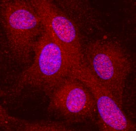 Complement Component C1qC in Human HUVEC. Complement Component C1qC antibody in Human HUVEC by Immunocytochemistry (ICC).