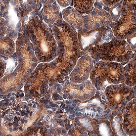 Complement Component C3d antibody in Rat Kidney by Immunohistochemistry (IHC-P).