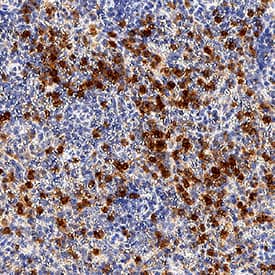 Complement Component C5aR1 antibody in Human Spleen by Immunohistochemistry (IHC-P).