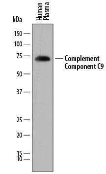 Detection of Human Complement Component C9 antibody by Western Blot.