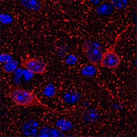 Complexin-1/2 antibody in Mouse Brain.