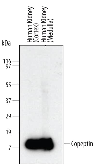 Detection of Human Copeptin antibody by Western Blot.