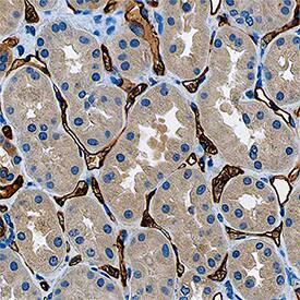 Corin antibody in Human Liver by Immunohistochemistry (IHC-P).