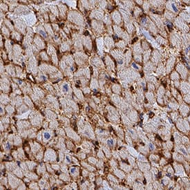 Corin antibody in Human Heart by Immunohistochemistry (IHC-P).