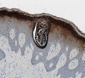 Corneodesmosin antibody in Human Skin by Immunohistochemistry (IHC-P).