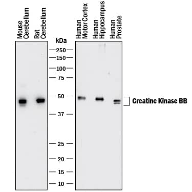 Detection of Human, Mouse, and Rat Creatine Kinase BB antibody by Western Blot.