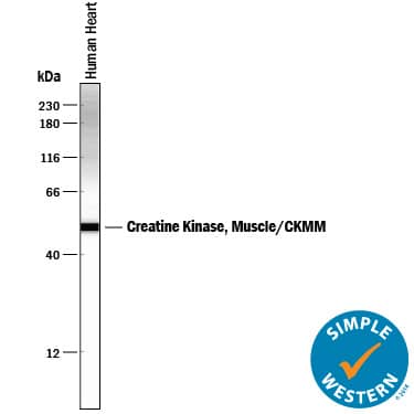 Detection of Human Creatine Kinase MM/CKMM antibody by Simple WesternTM.