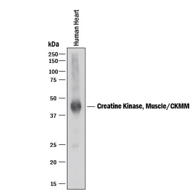 Detection of Human Creatine Kinase MM/CKMM antibody by Western Blot.