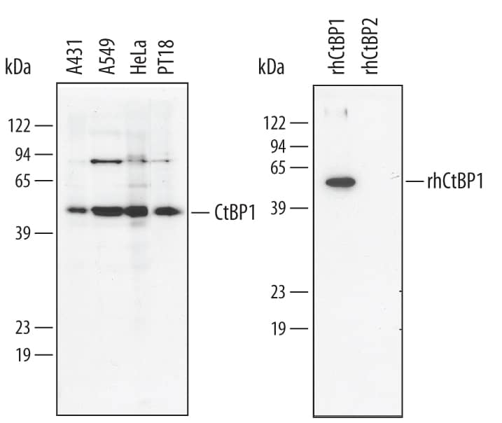 Detection of Human CtBP1 antibody by Western Blot.